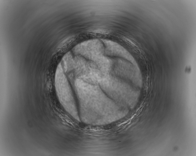 X0000098200774200805151227