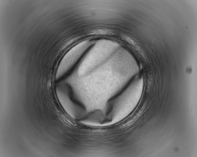 X0000098201017200805151223