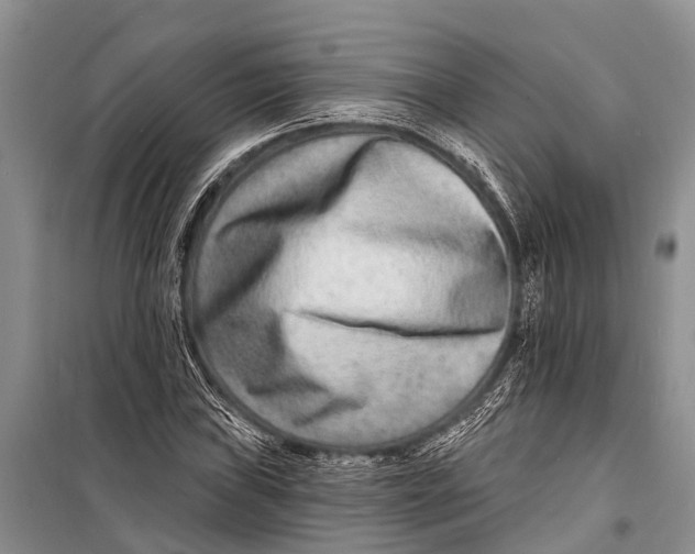 X0000098201019200805151223