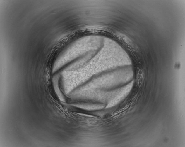 X0000098201062200805151223
