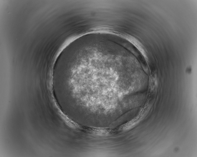 X0000098201101200805151222