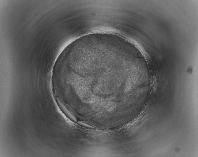 X0000098201103200805151222