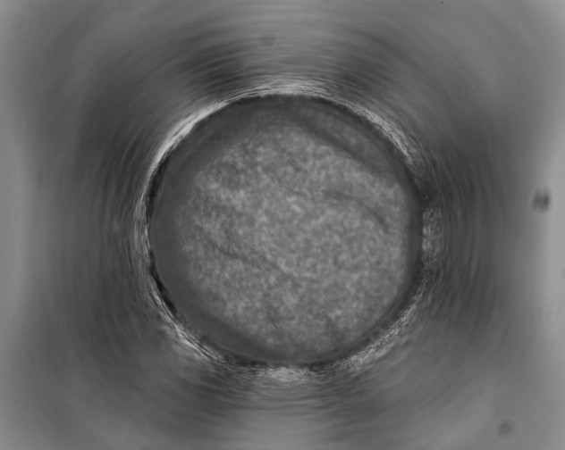 X0000098201117200805151222