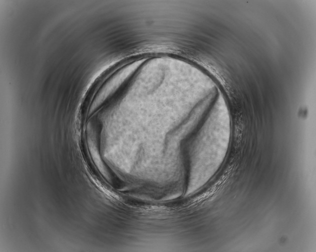 X0000098201119200805151222