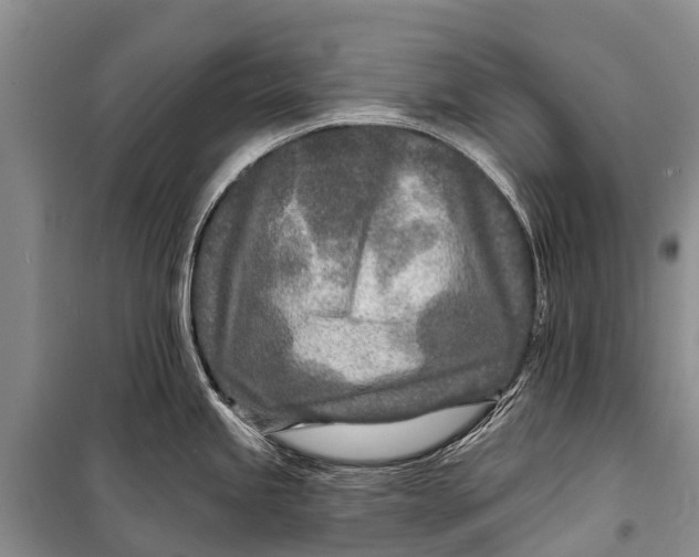 X0000098201245200805151221