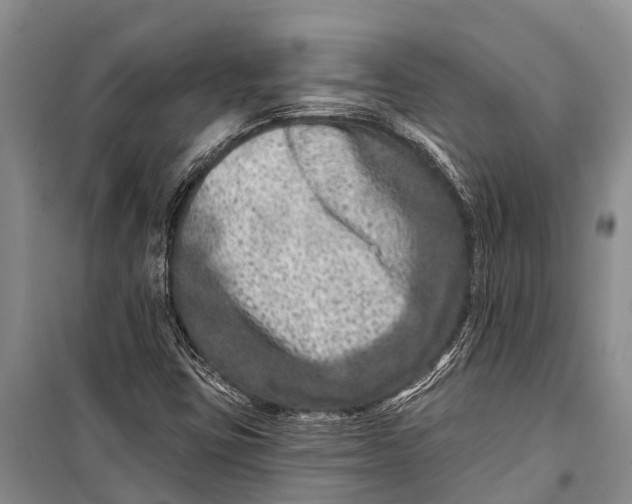 X0000098201403200805151217