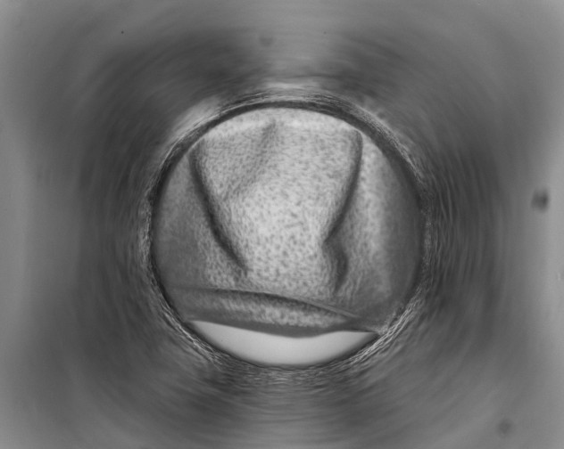 X0000098201411200805151217