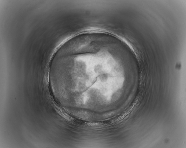 X0000098201413200805151217