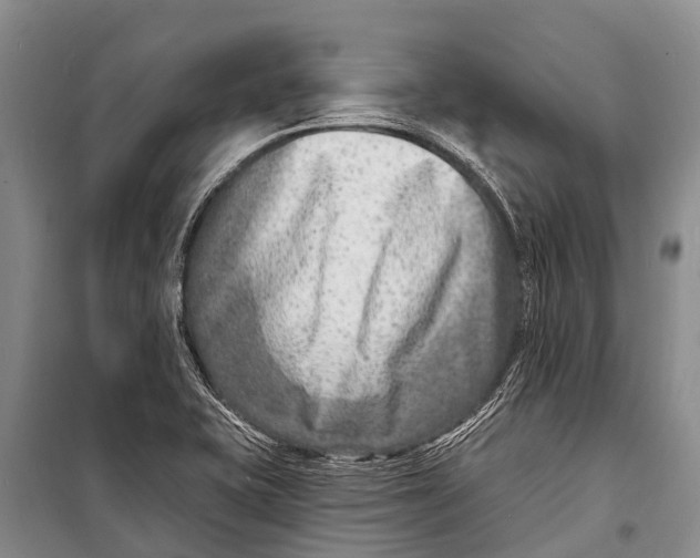 X0000098201415200805151217