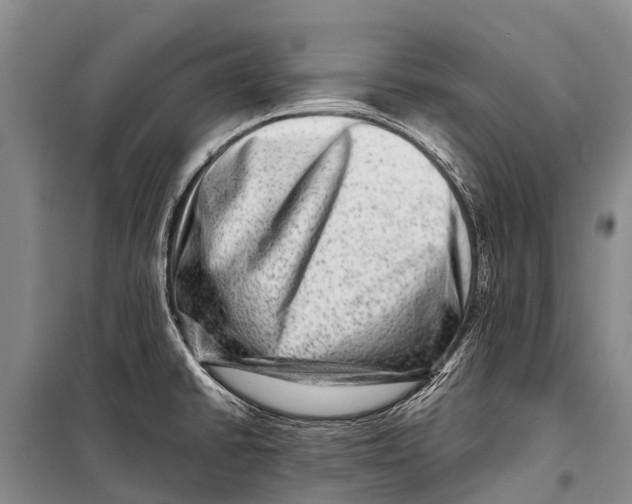 X0000098201430200805151218