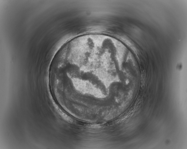 X0000098201431200805151218