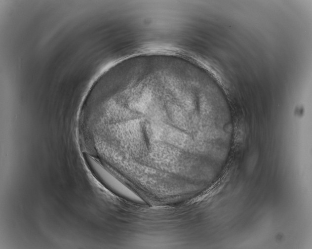 X0000098201471200805151217