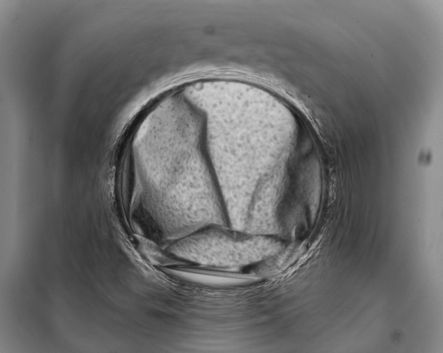 X0000098201503200805151216
