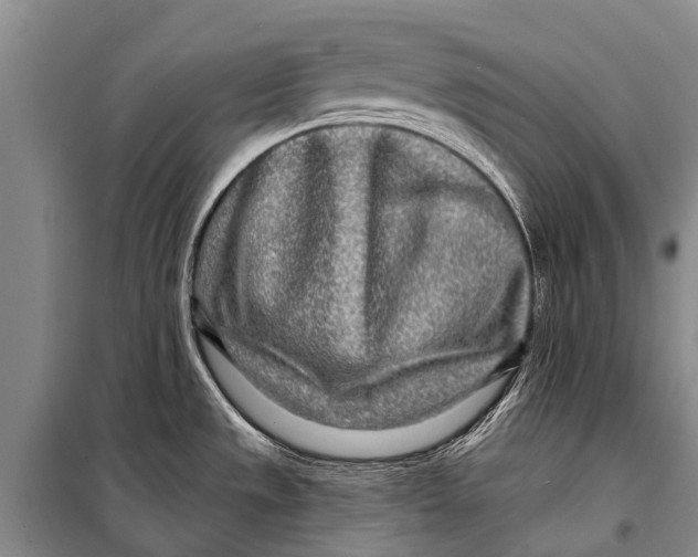 X0000098201533200805151216