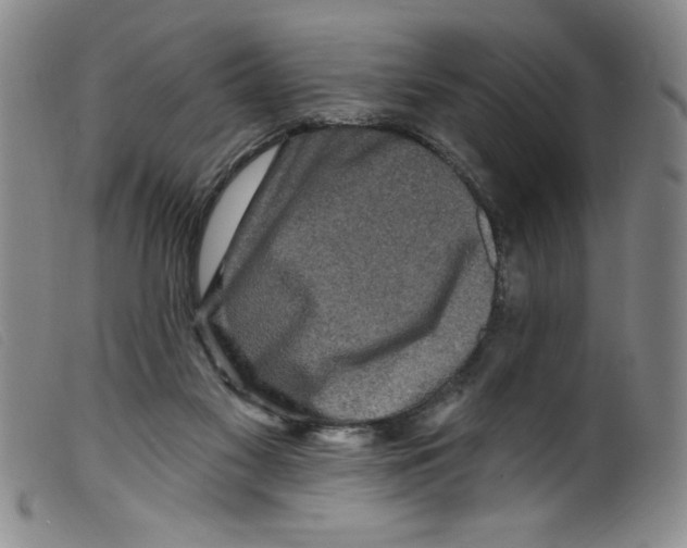X0000098200117200805221551
