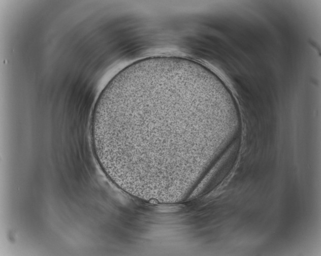 X0000098201440200805221531