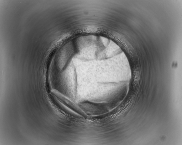 X0000098210542200805081137