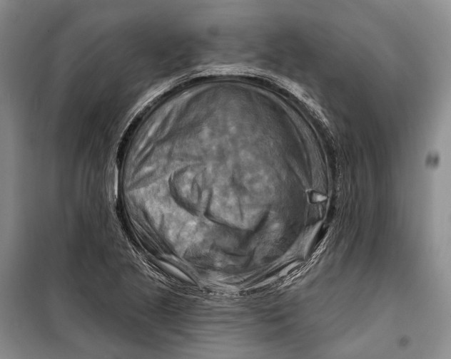 X0000098211221200805151244
