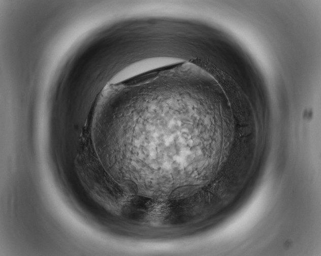 X0000098220143200805011243