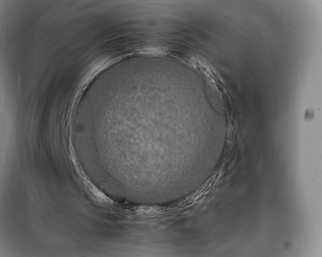 X0000098220145200805011242