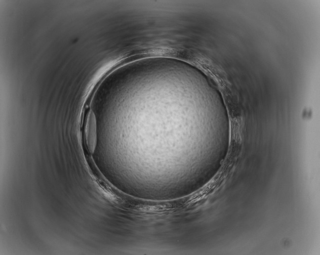 X0000098220147200805011242