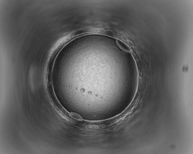 X0000098220149200805011242