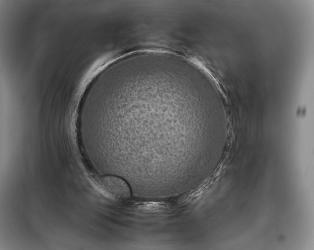 X0000098220151200805011242