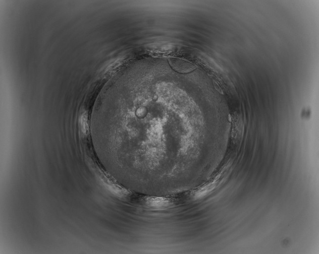 X0000098220287200805011241