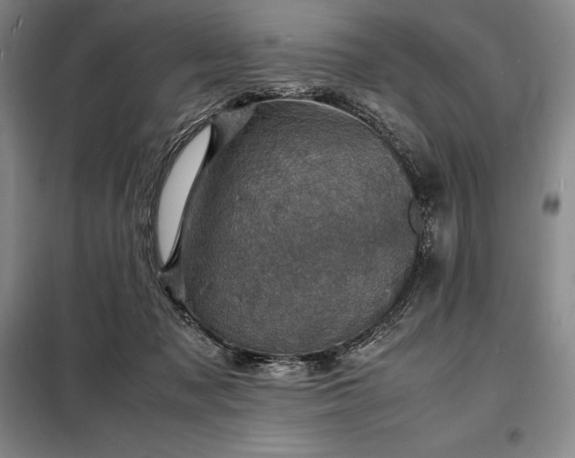 X0000098220317200805011240