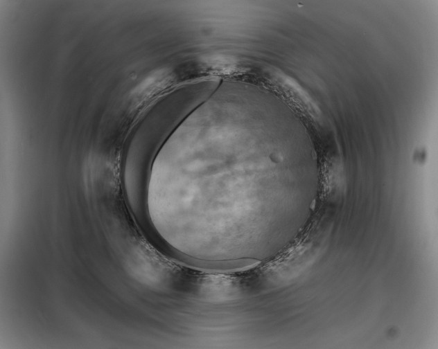 X0000098220376200805011240