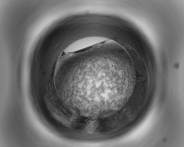 X0000098220143200805081207