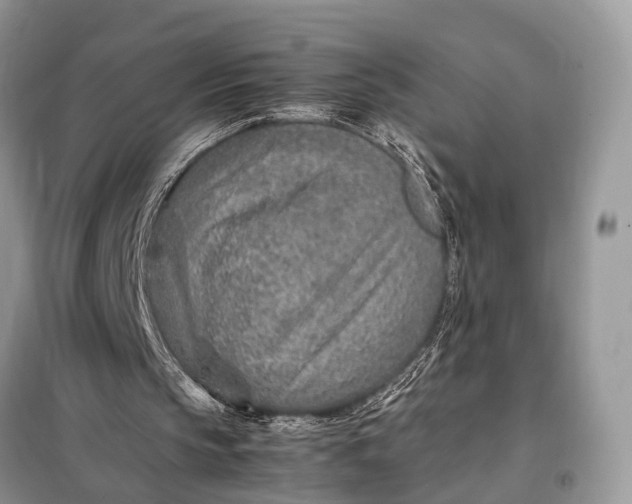 X0000098220145200805081206