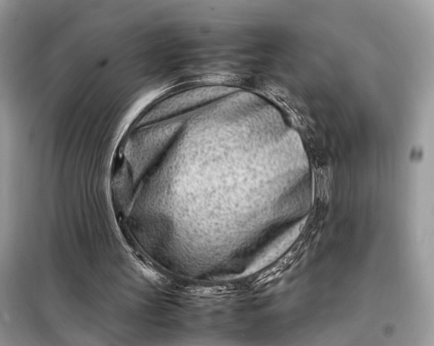 X0000098220147200805081206