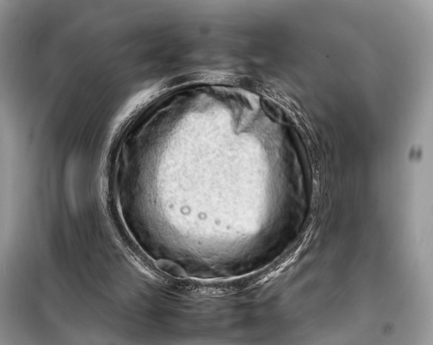 X0000098220149200805081206