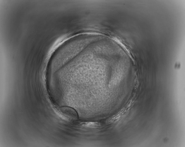 X0000098220151200805081206