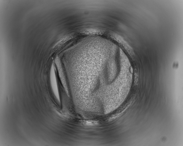 X0000098220165200805081207