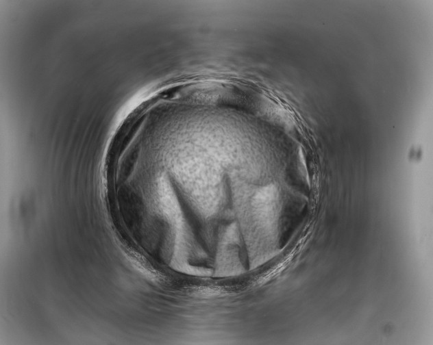 X0000098220246200805081205