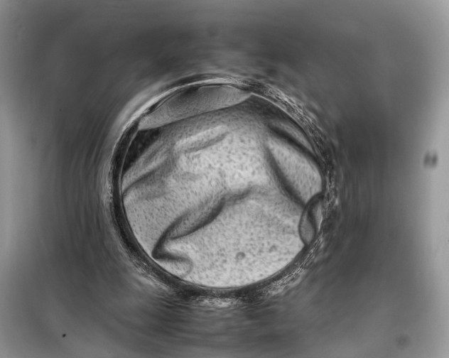 X0000098220247200805081205