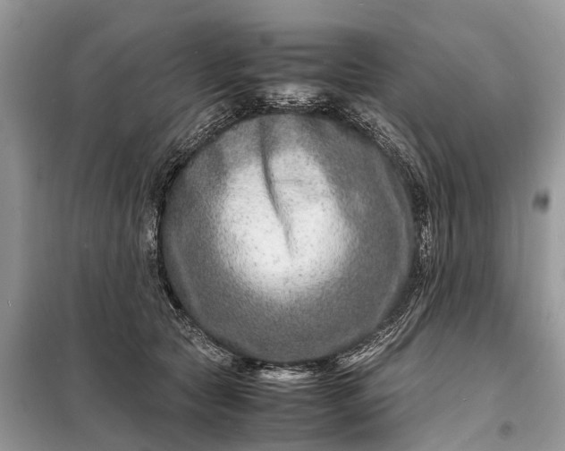 X0000098220561200805081201