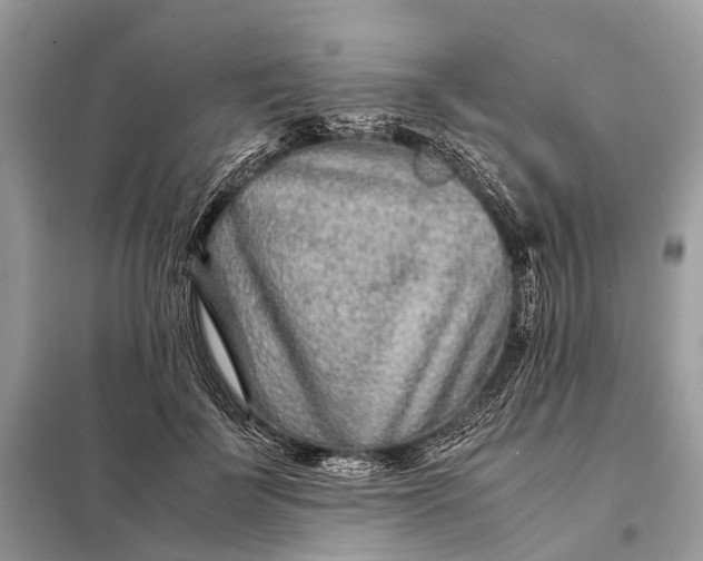 X0000098220699200805081158