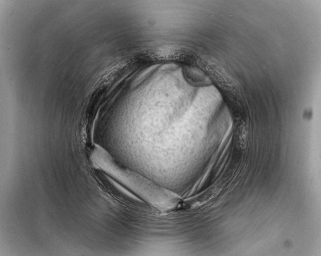 X0000098220746200805081158