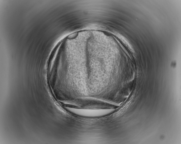 X0000098220854200805081156