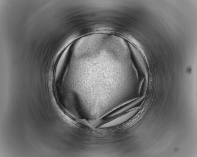 X0000098220859200805081156