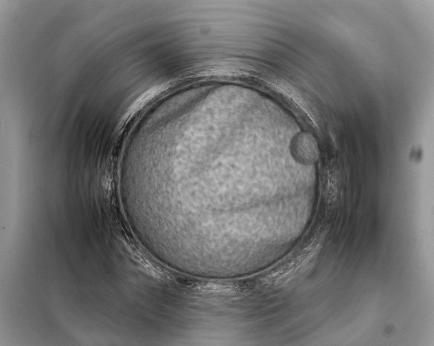 X0000098220874200805081156