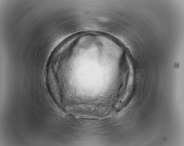 X0000098220879200805081156