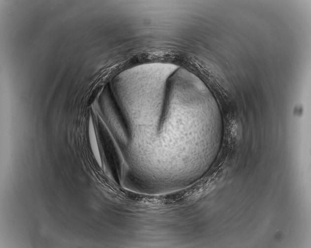 X0000098220914200805081154