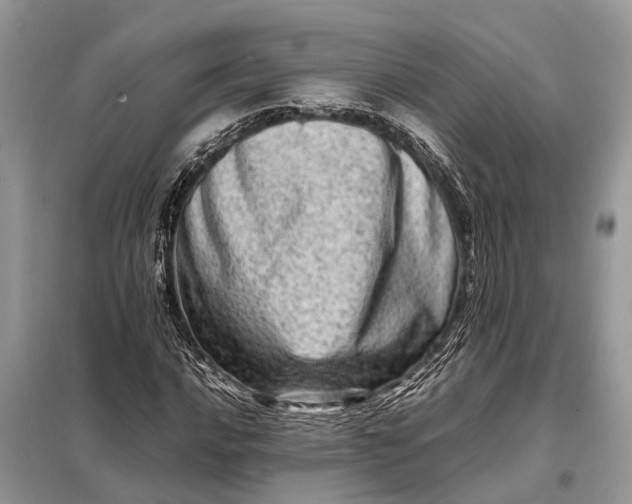 X0000098221016200805081153