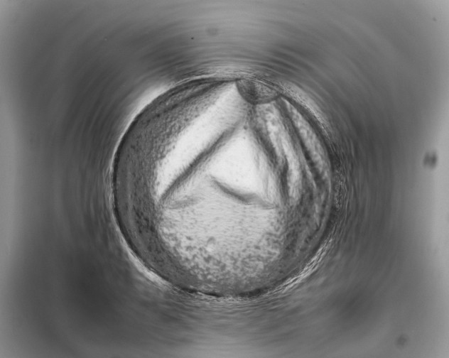 X0000098221087200805081152