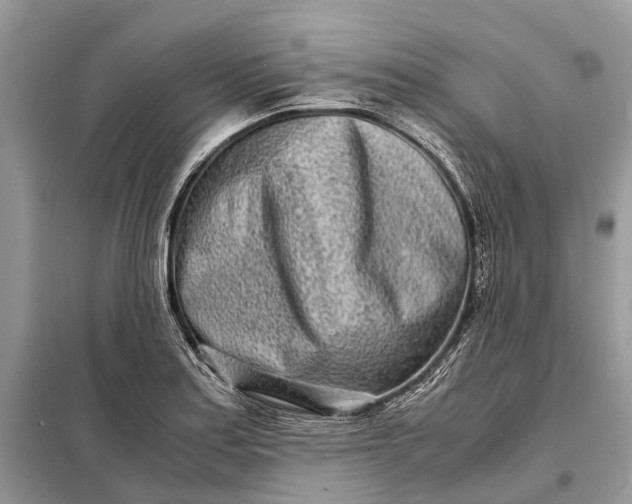 X0000098221179200805081151