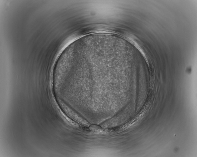 X0000098221195200805081151